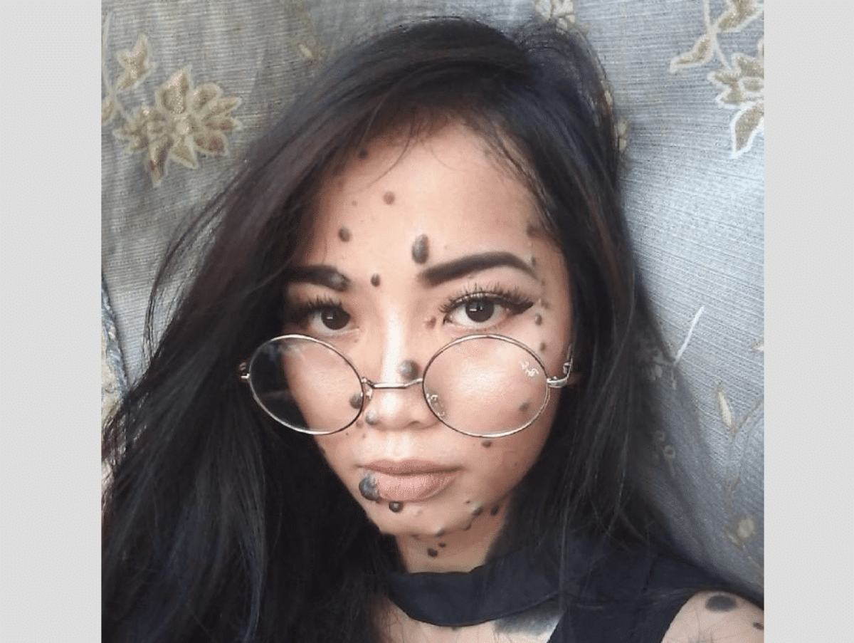 La Ragazza Ricoperta Di Nei Che Ha Deciso Di Partecipare Alle Selezioni 