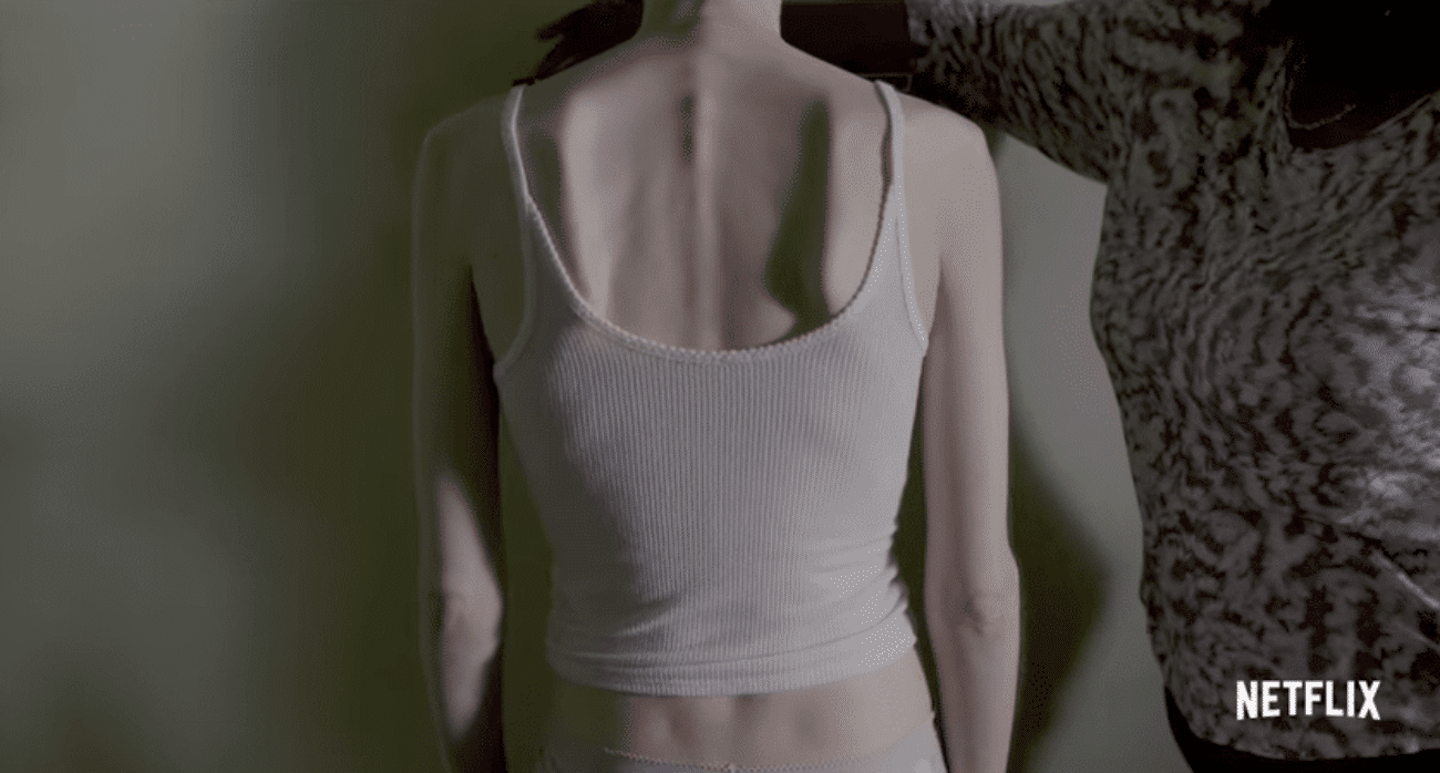 Il nuovo film di Netflix sull'anoressia
