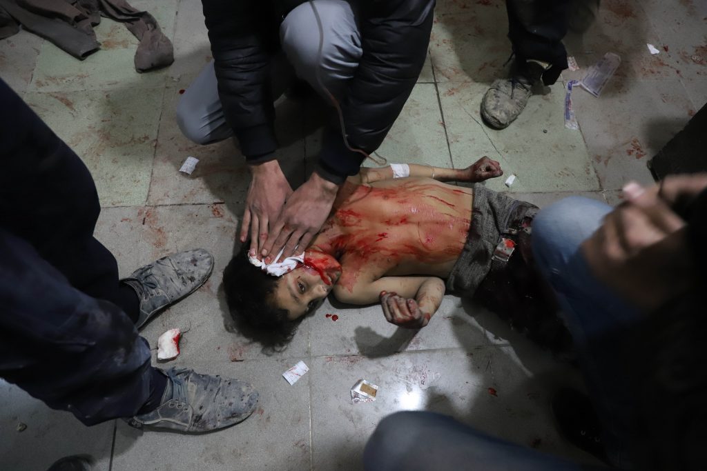 Siria bambini uccisi guerra