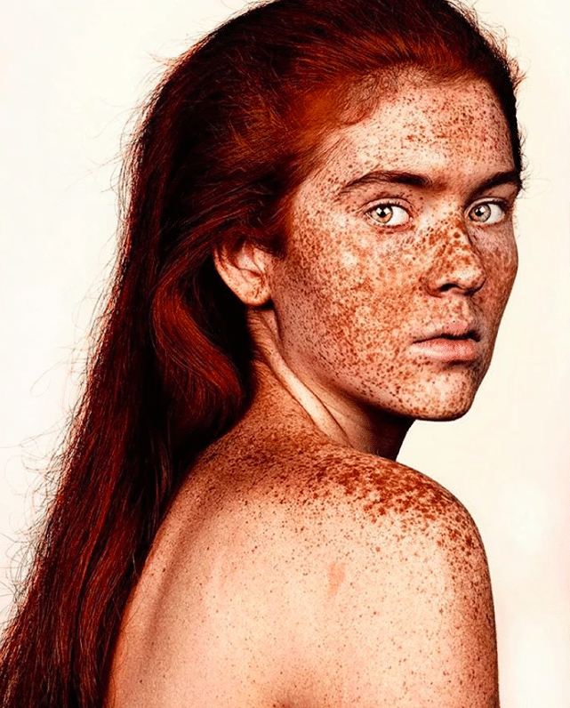 La bellezza delle lentiggini in una serie di foto TPI