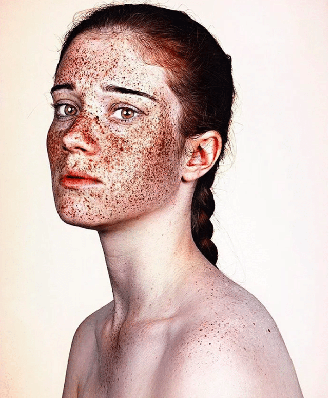 La bellezza delle lentiggini in una serie di foto TPI
