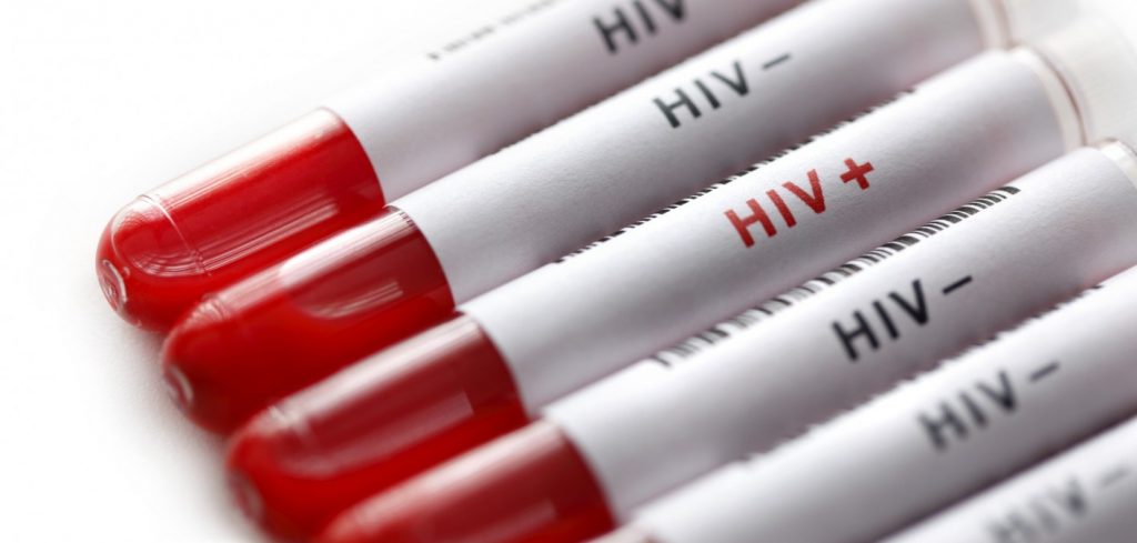 hiv italiani test