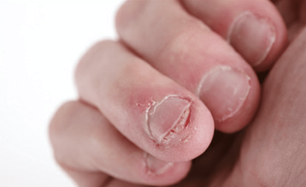 uomo rischia vita unghie