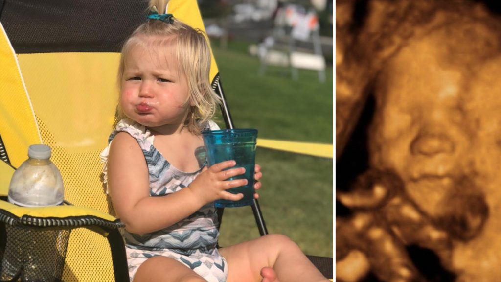 bode miller moglie ecografia