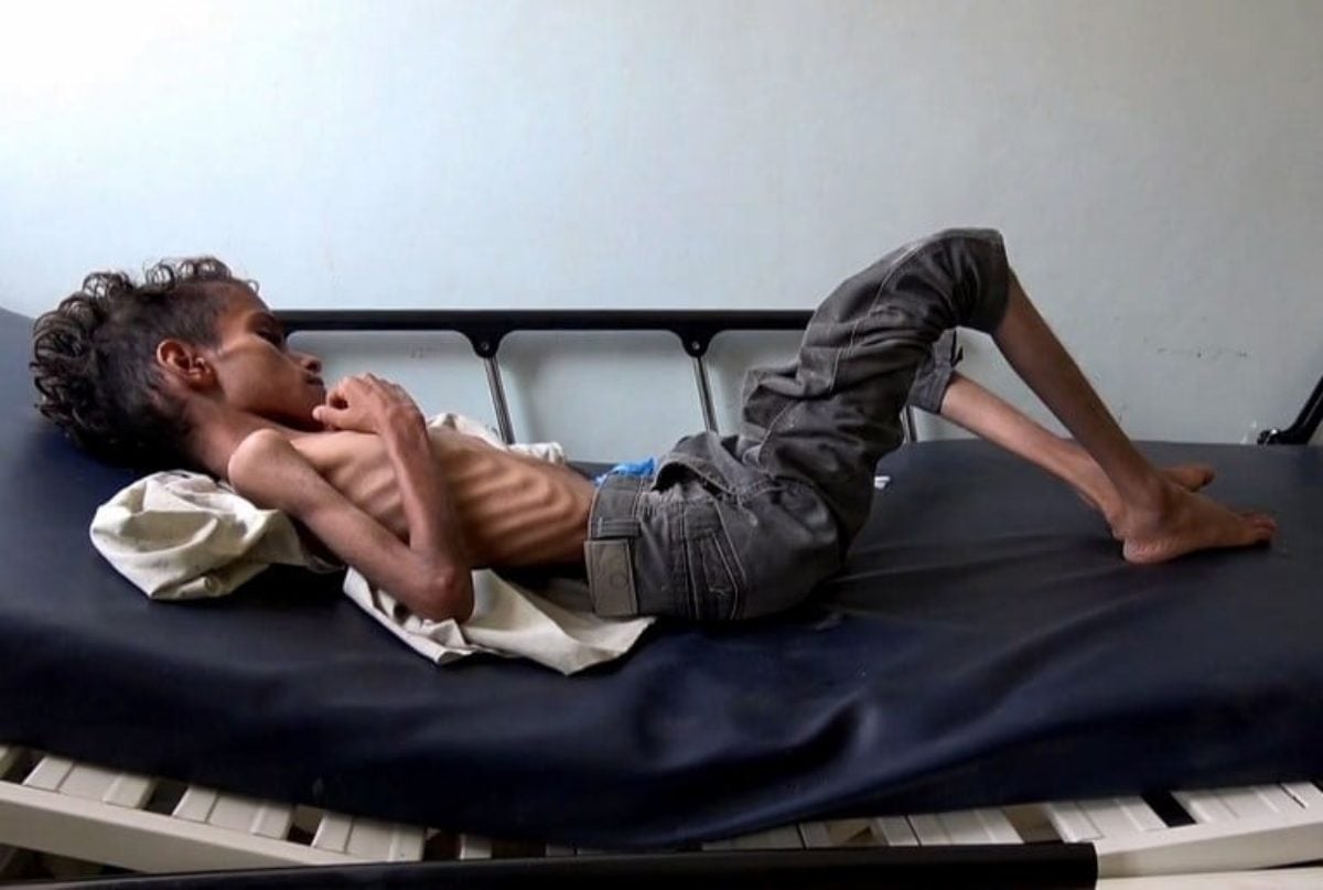 yemen bambini morti conflitto