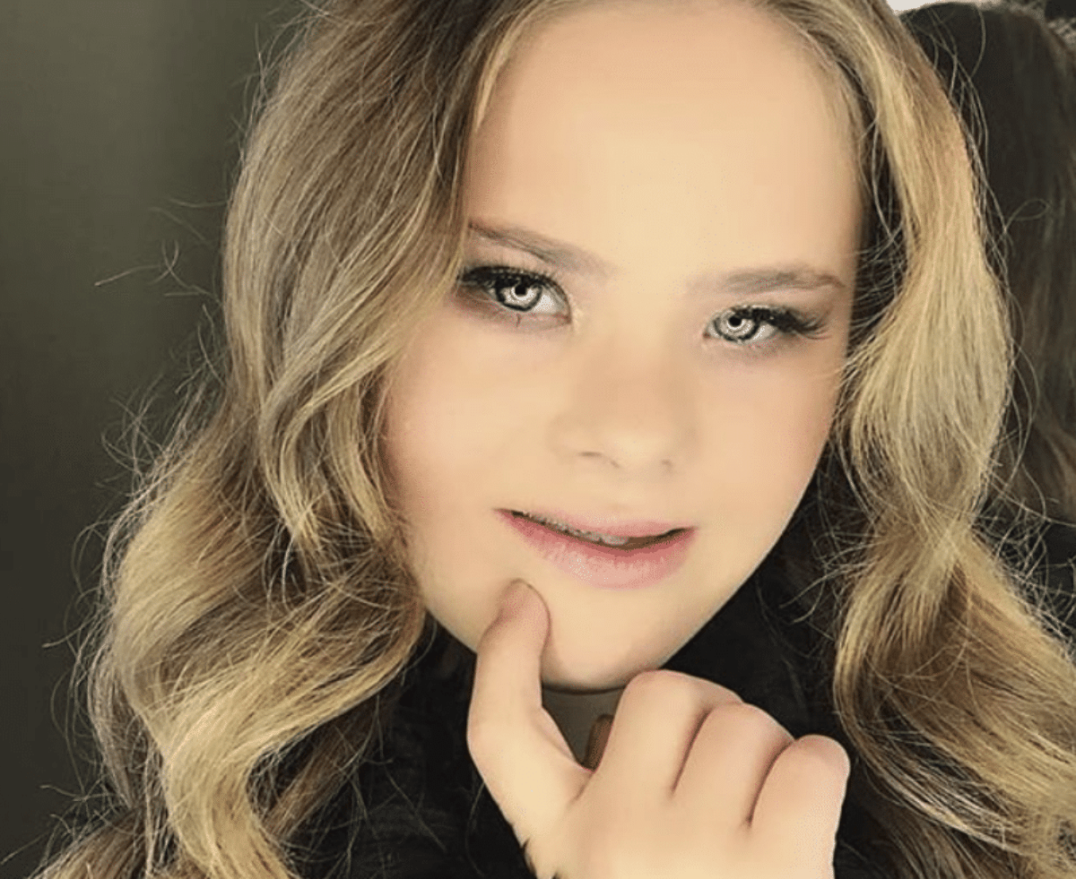 Modella Down Mamma condivide foto della figlia down, la 15enne diventa una modella