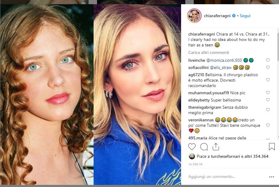 Chiara Ferragni foto adolescente