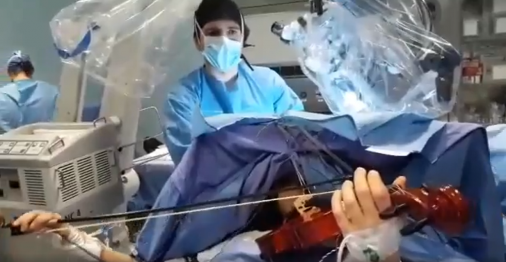operata cervello suona violino