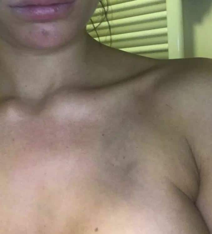 Josie Gibson Thomas Jenkins