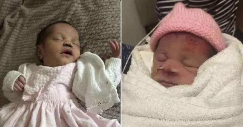 bambina taglio faccia bisturi