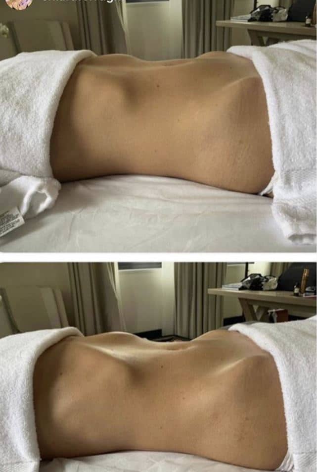 massaggi chiara ferragni