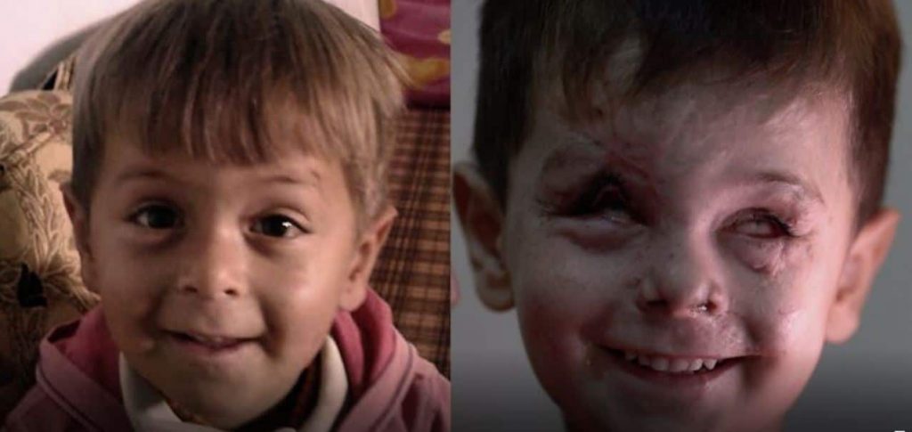 volto bambino bombardamento siria