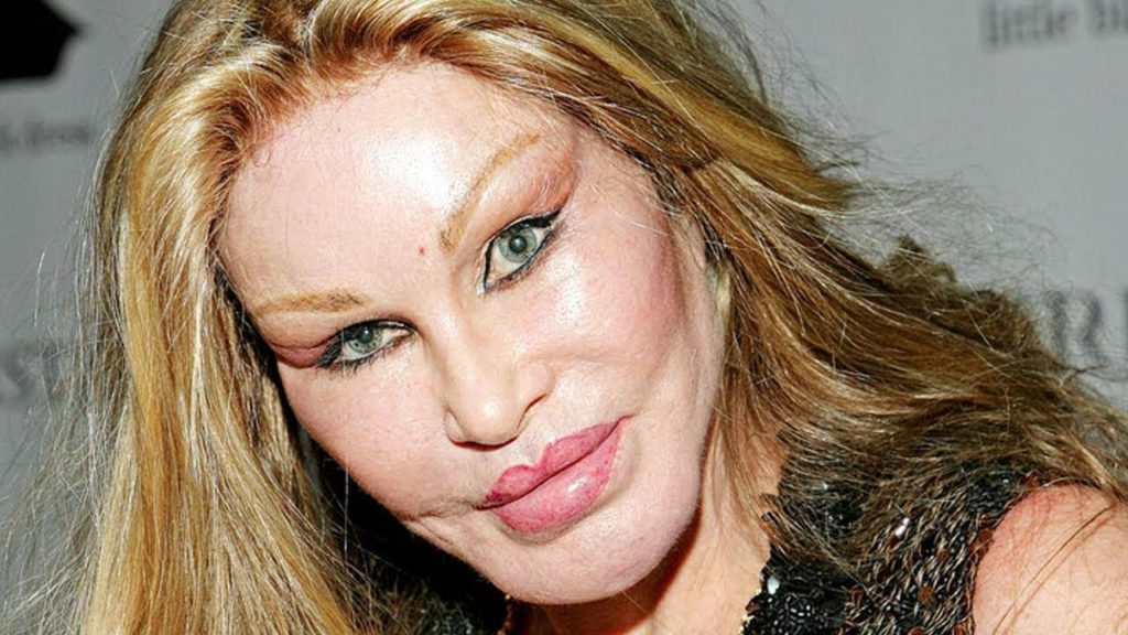 Jocelyn Wildenstein