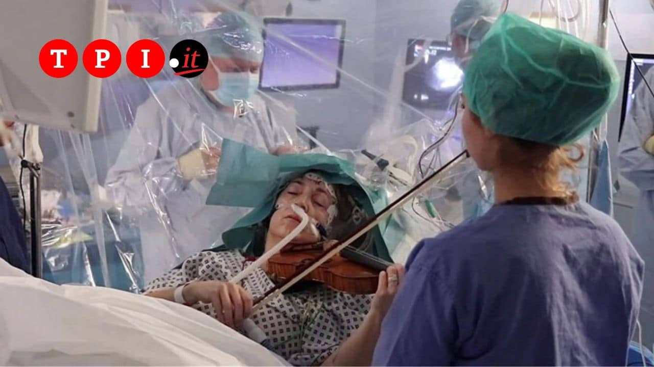 Suona il violino durante l'operazione al cervello VIDEO