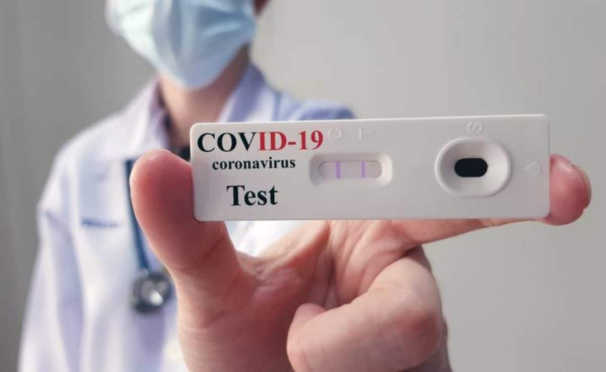 coronavirus test seriologico