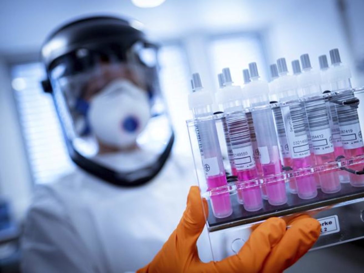 coronavirus test immunità