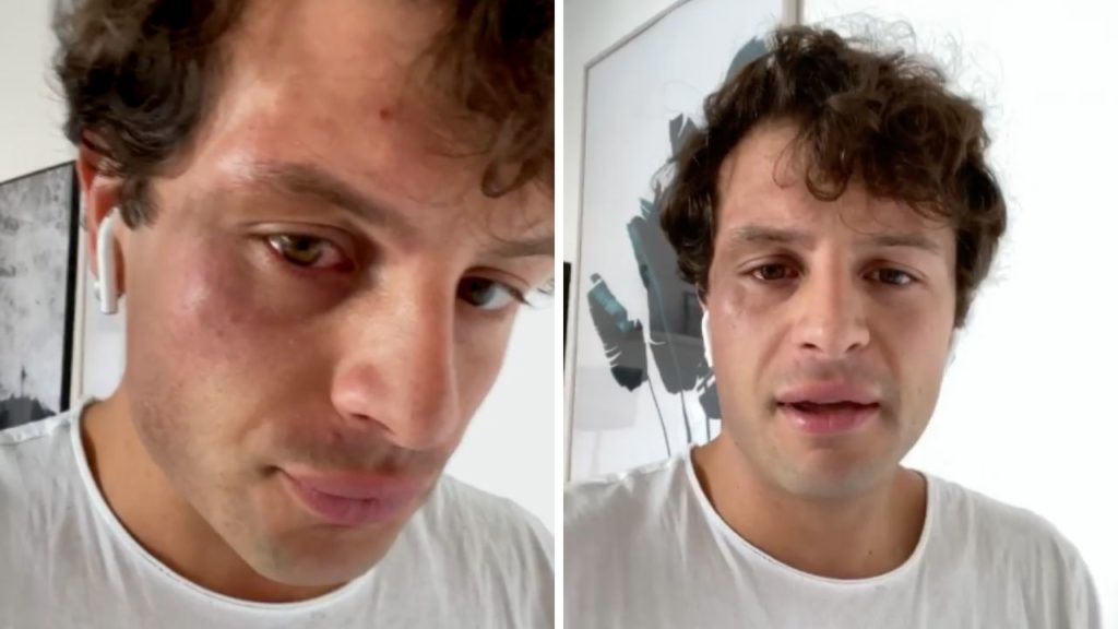 milano aggressione omofoba