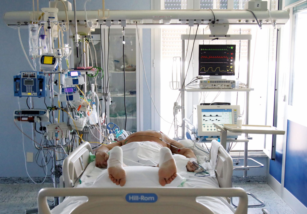 coronavirus 17enne terapia intensiva