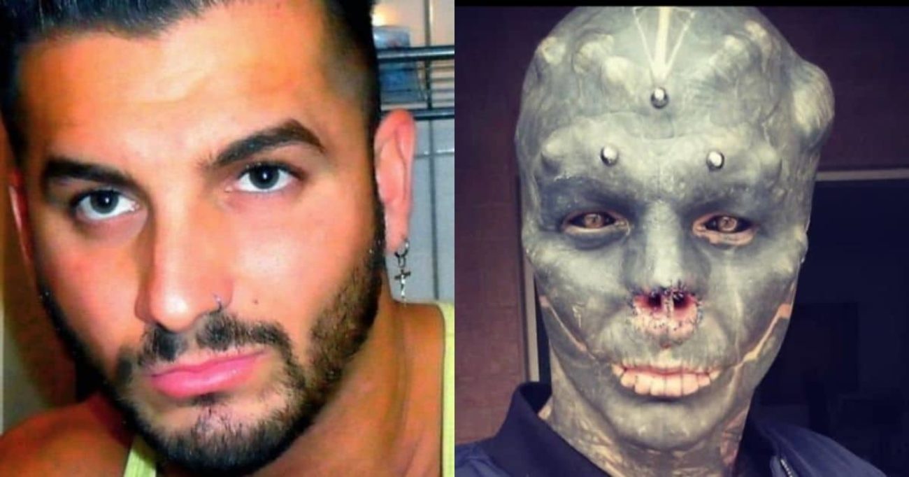 “Voglio essere spaventoso”: 32enne si fa asportare naso e orecchie per somigliare a un alieno