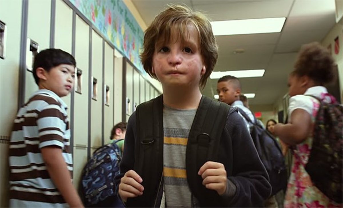 Wonder la malattia del bambino protagonista del film