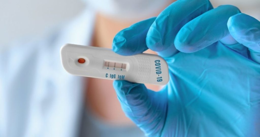 covid bollettino oggi