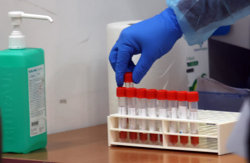 covid sottovarianti sintomi