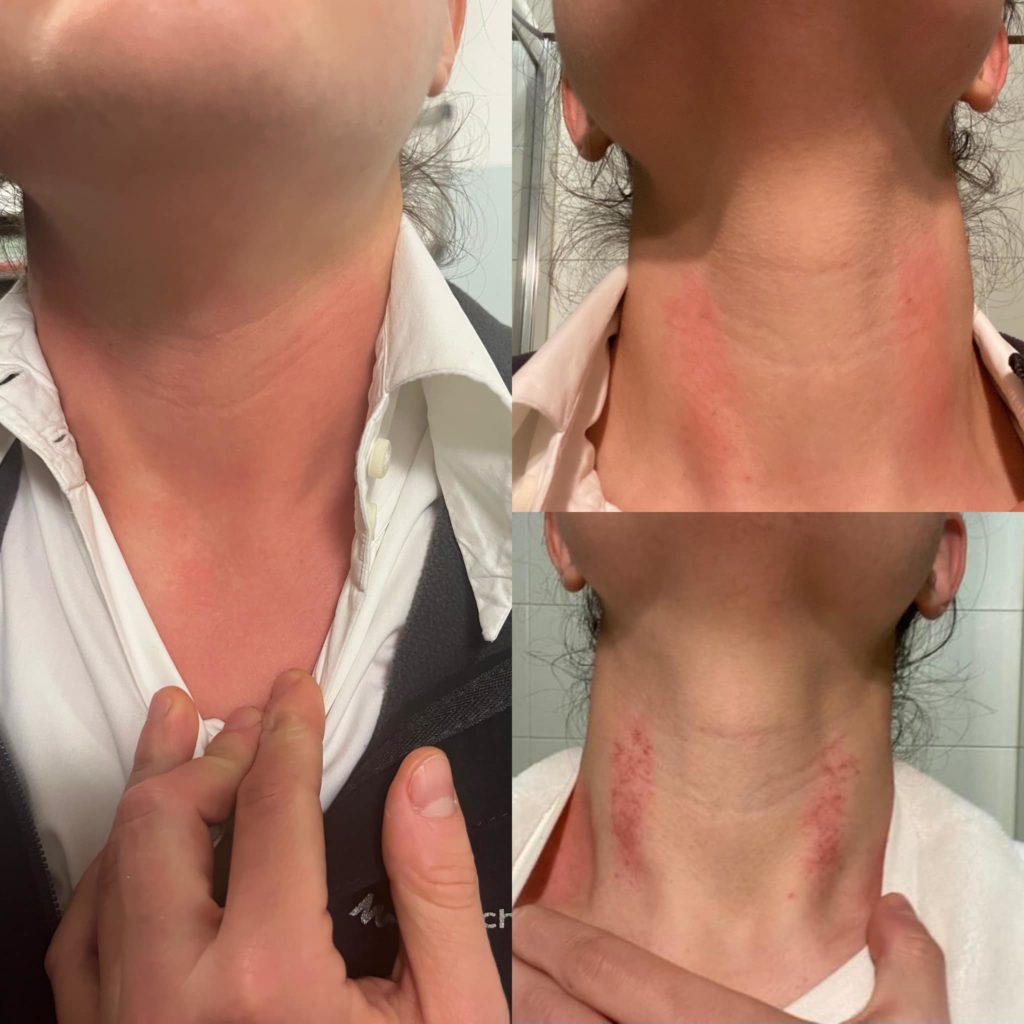 specializzanda aggredita udine strangolata