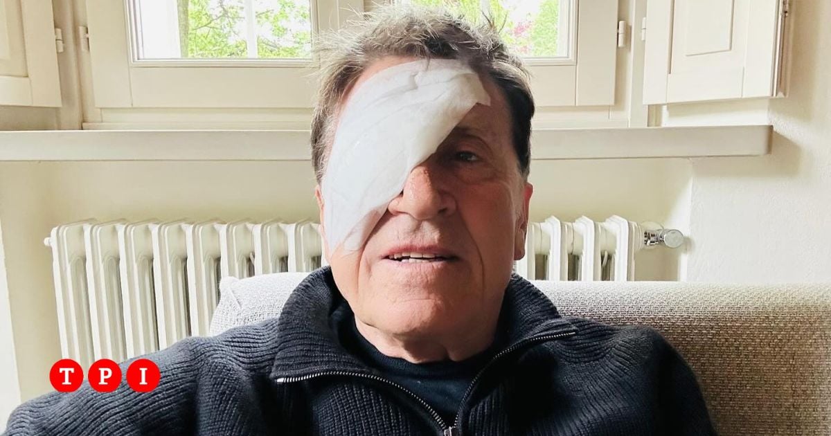 Paura per Gianni Morandi, sui social posta una foto con l’occhio bendato: “Ho fatto a pugni”