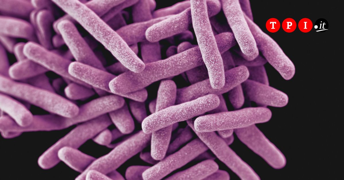 focolaio di tubercolosi all8217istituto di medicina legale di milano almeno 8 contagi tra i medici da Tpi.it focolaio di tubercolosi all8217istituto di medicina legale di milano almeno 8 contagi tra i medici